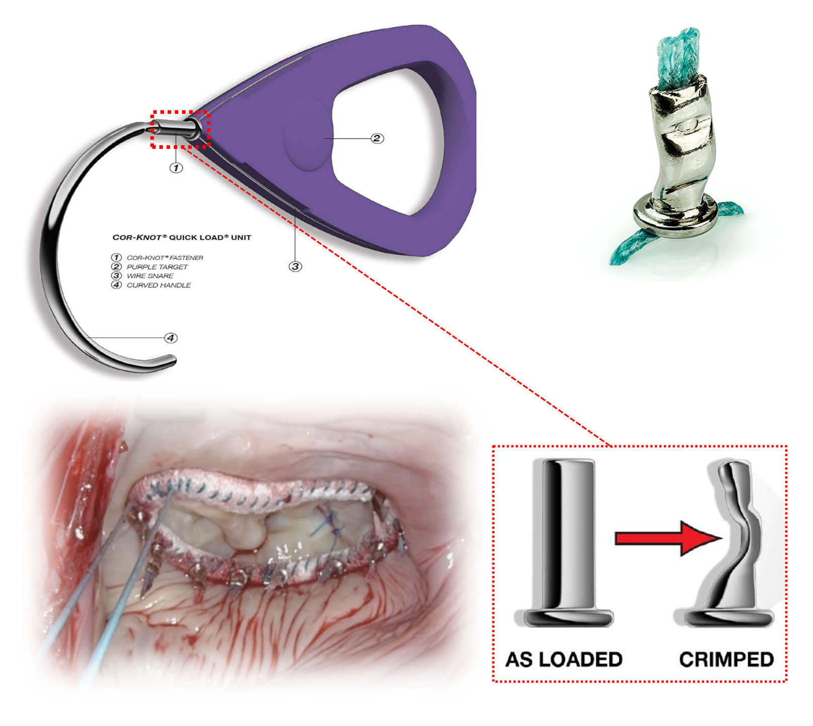 COR-KNOT® QUICK LOAD® UNIT【純チタン製クリップ】