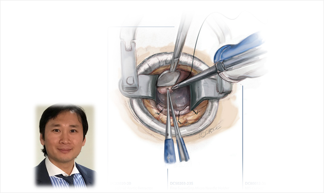 Professor Tristan D. Yan Royal Prince Alfred Hospital / Sydney Adventist Hospital University of Sydney, Australia